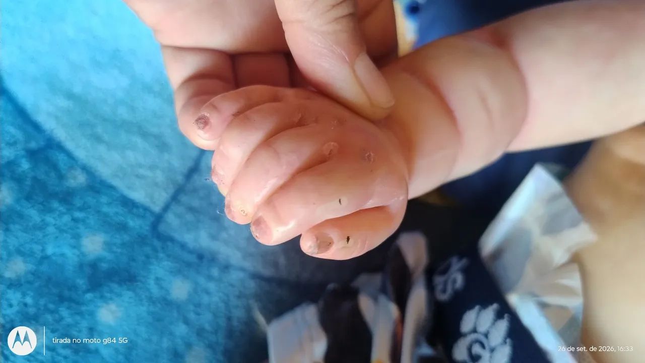 Bebê rebom  - Foto 2