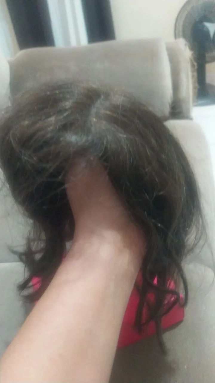 Prótese capilar  - Foto 3