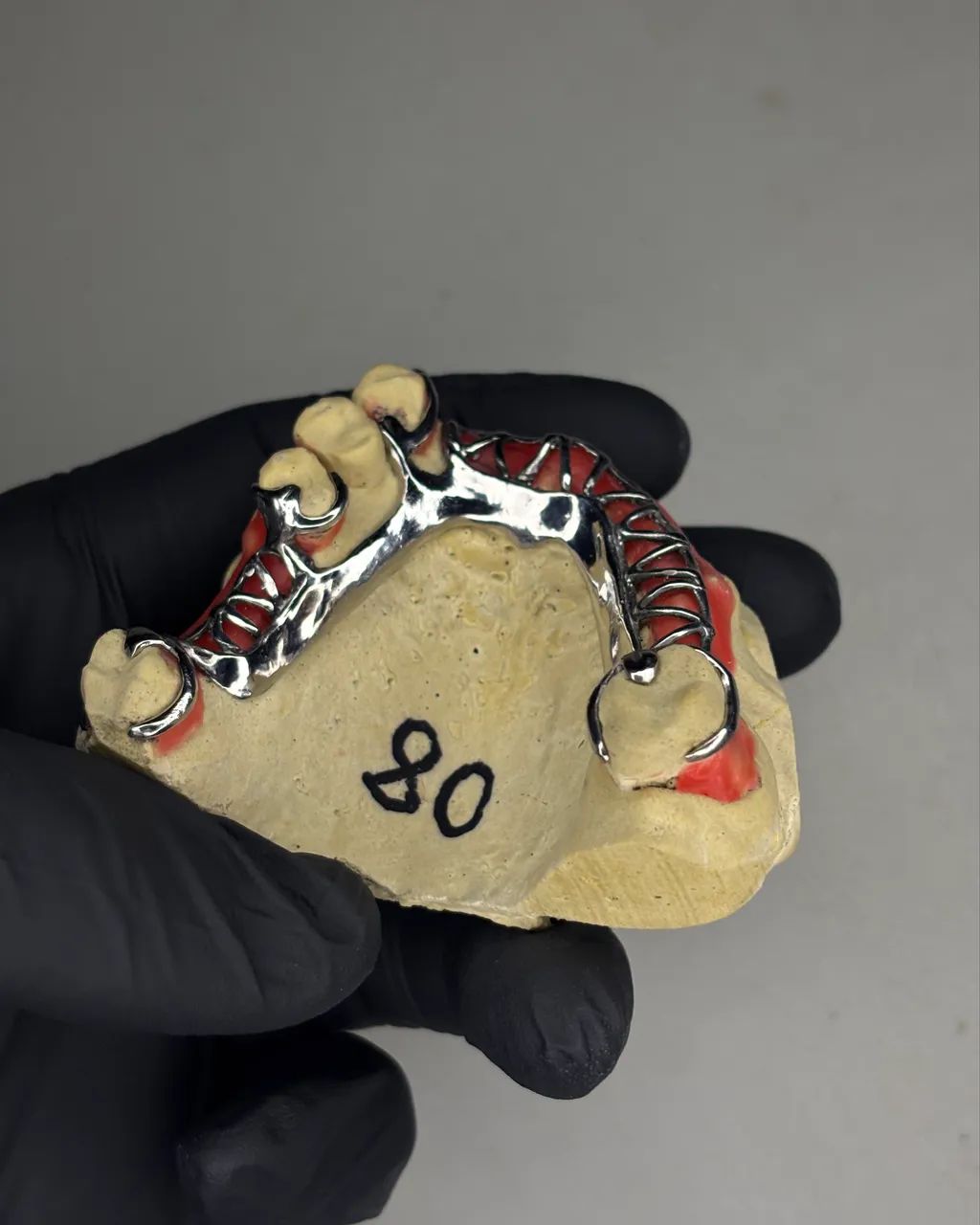 PPR. Prótese Parcial Removível Metálica - Foto 2