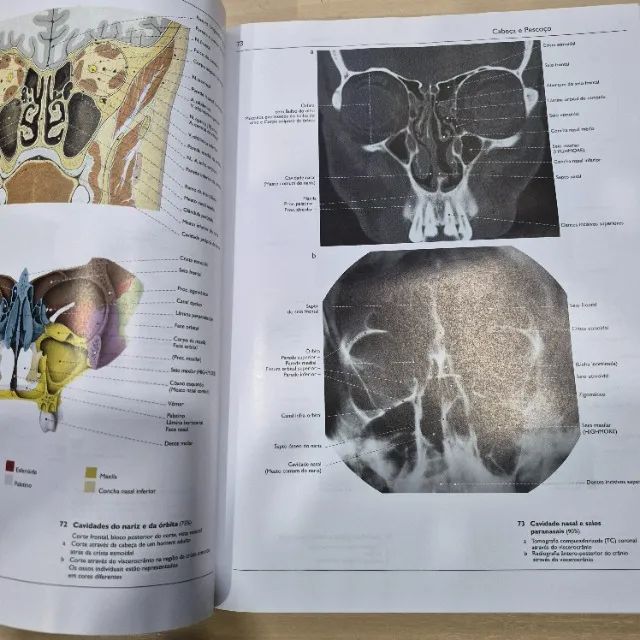 Atlas de anatomia Wolf Heidegger 6 edição - Foto 3