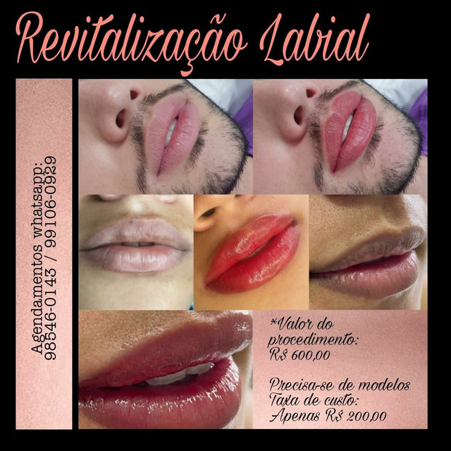 Revitalização Labial