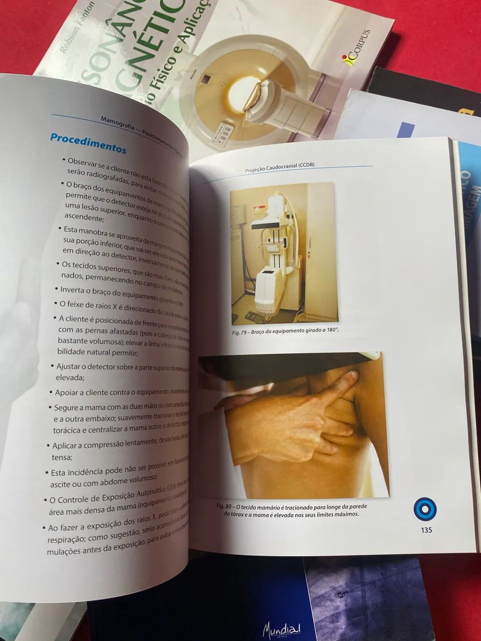 Coleção de Livros de Radiologia - Excelente Oportunidade ! - Foto 3