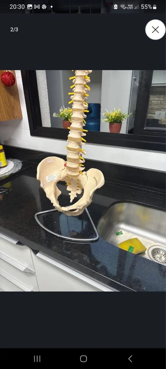 Modelo de coluna vertebral - Foto 2