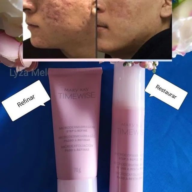 Kit Microdermoabrasão Timewise Mary Kay 