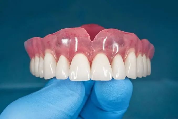 Prótese Dentária - Foto 3