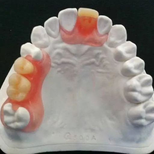 Prótese Dentária - Foto 4