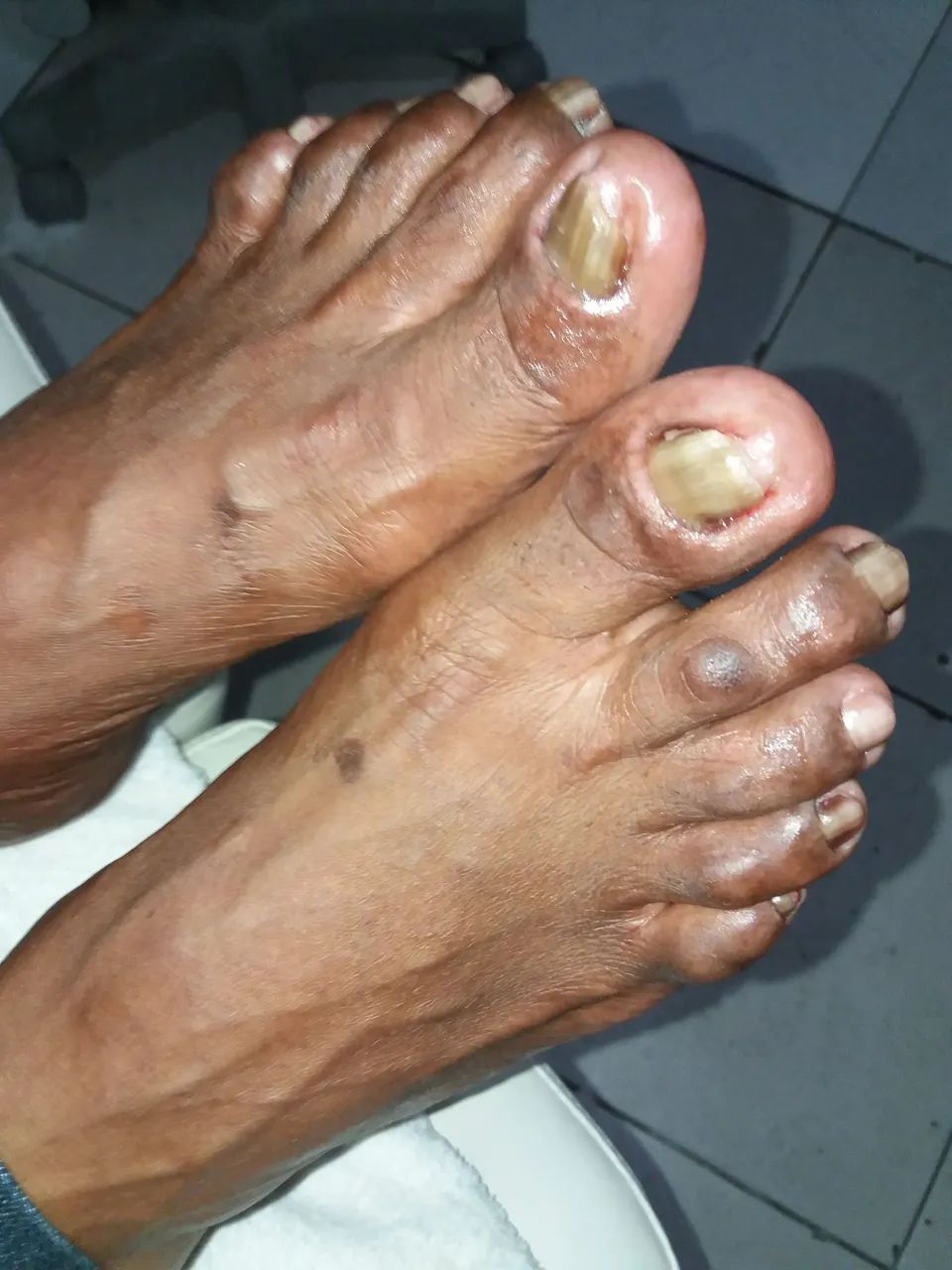 Podologia - Foto 2