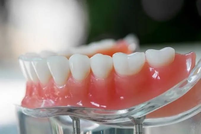 Prótese Dentária - Foto 2