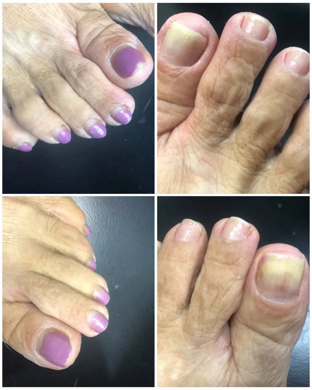 ESMALTAÇÃO EM GEL PARA PÉS