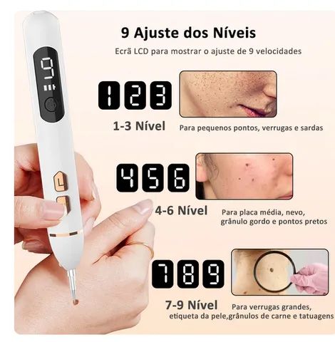 Caneta laser removedora de sinais - Foto 3