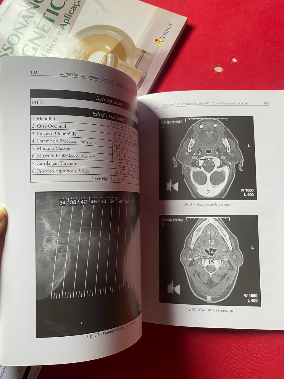 Coleção de Livros de Radiologia - Excelente Oportunidade ! - Foto 4