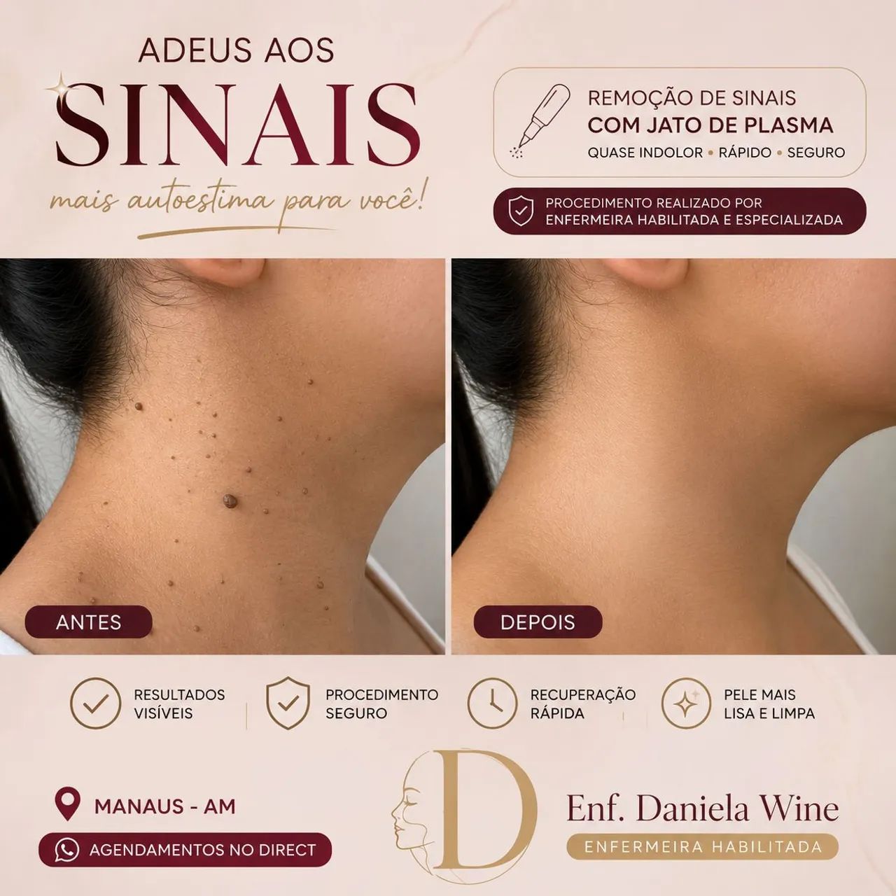 Remoção de sinais