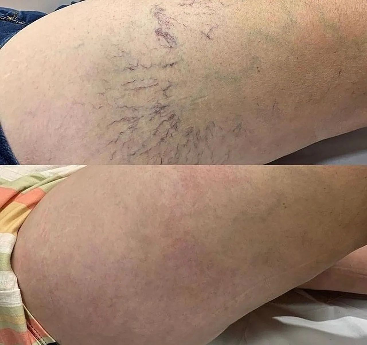 Estética domicílio  - Foto 2