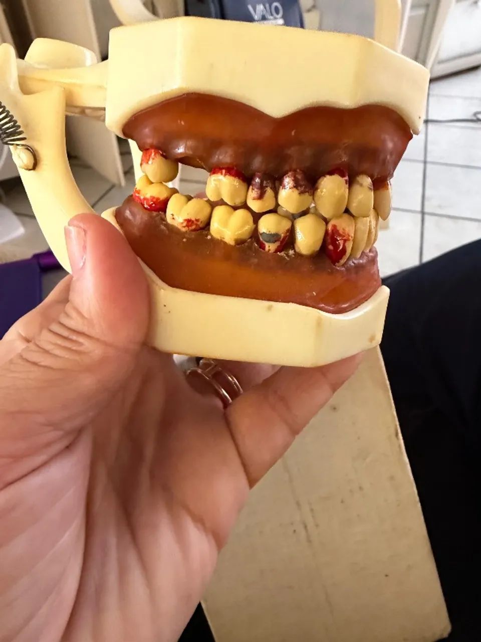 Manequim dentário modelo F2 - Foto 2