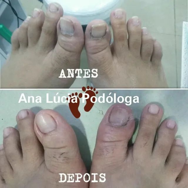 Podologia  - Foto 6