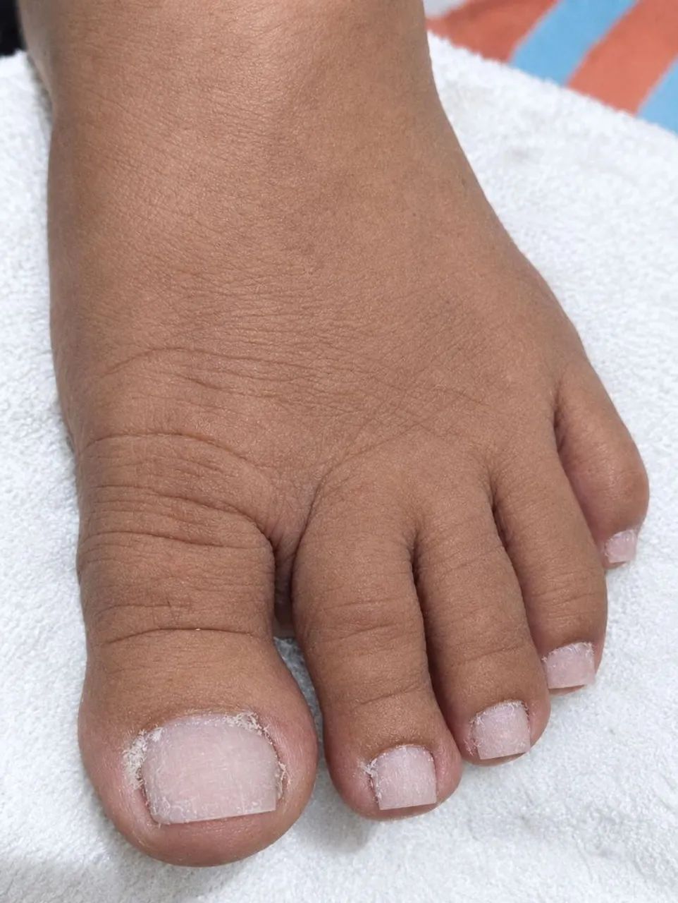 Manicure a domicílio  - Foto 5