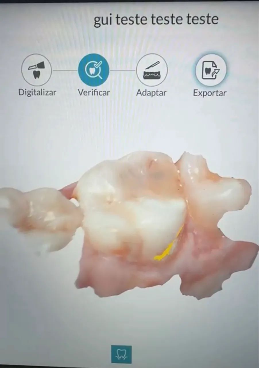 Scanner odontológico  - Foto 3