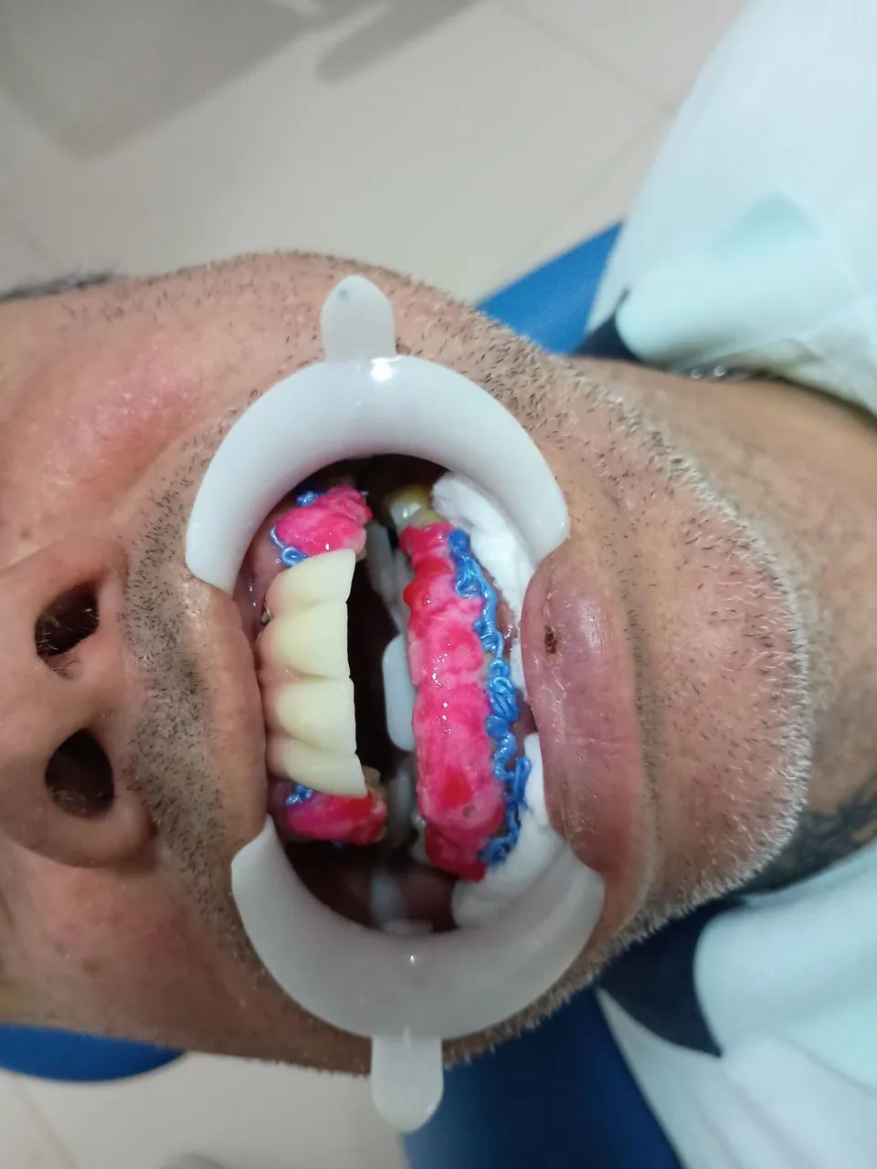 Dentista a domicílio  - Foto 2