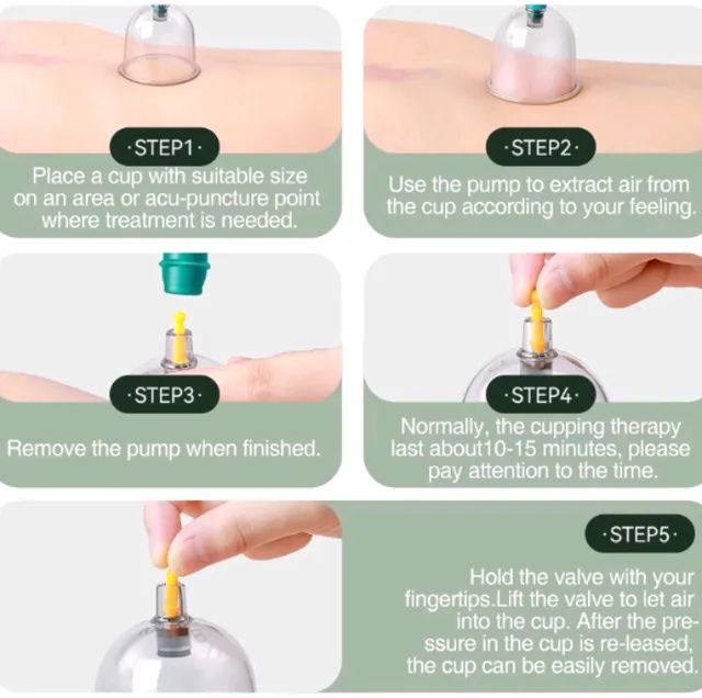 Ventosa terapêutica kit com 12 peças  - Foto 3