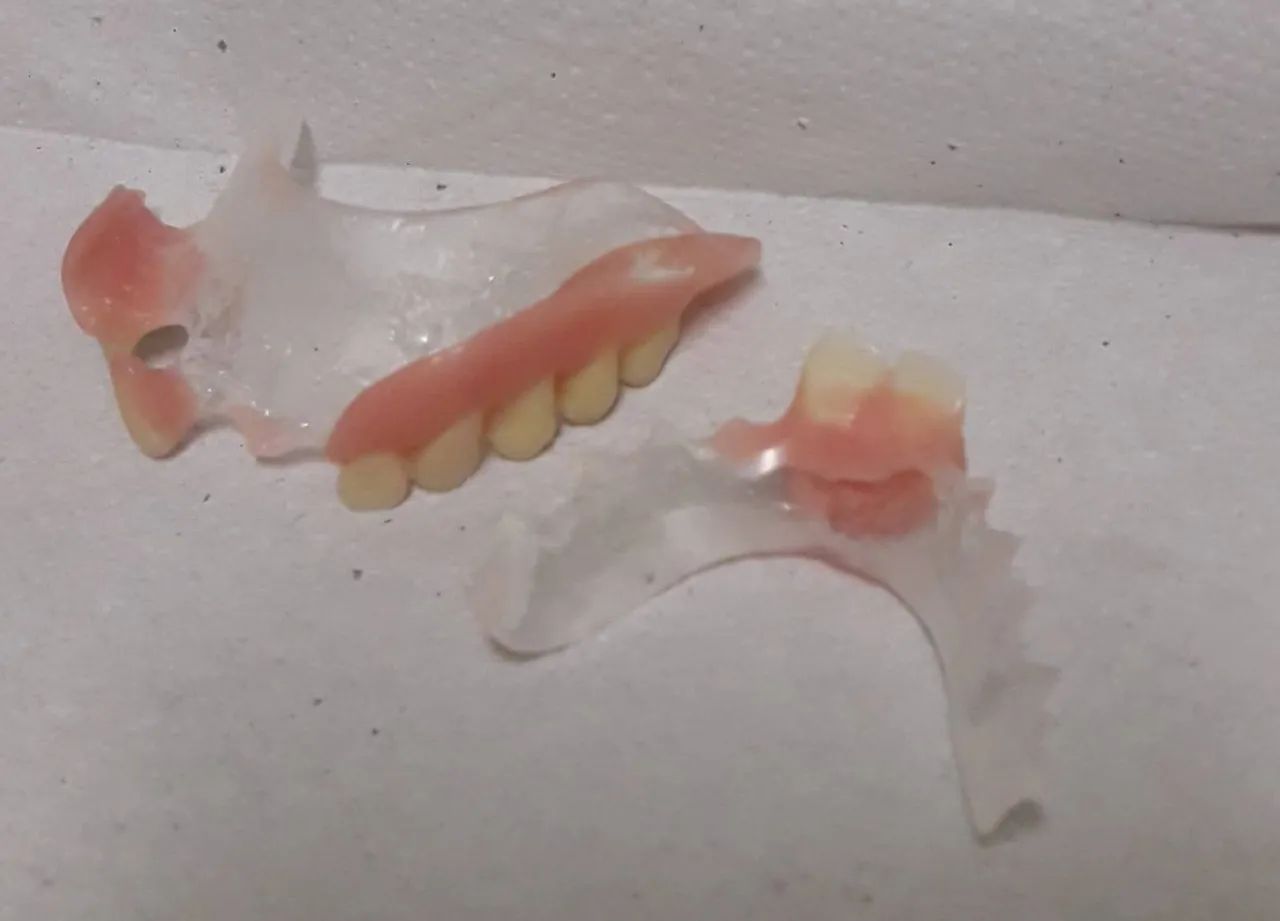 Dentadura (prótese dentária) - Foto 4