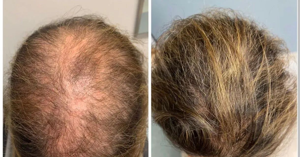 Barba, cabelo e sombrancelhas  - Foto 2