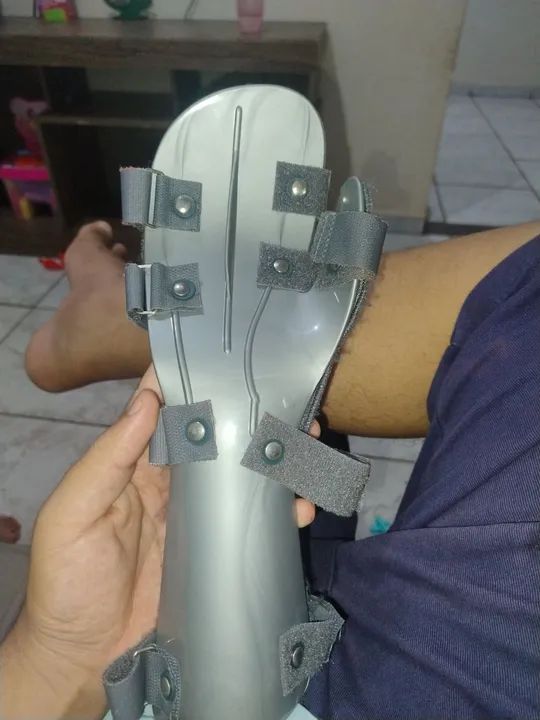 Ortese de Punho para Fratura 