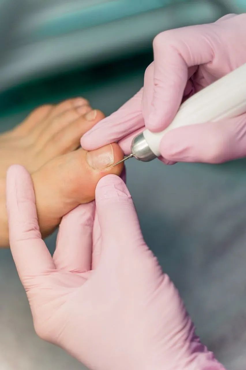 PODOLOGIA.   ( Belém e Ananindeua) - Foto 2