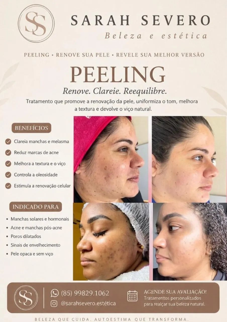 ESTETICISTA (CLAREAMENTO FACIAL/CORPORAL)