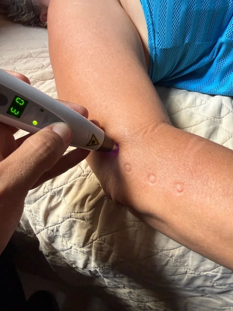 Fisioterapia Domiciliar  - Foto 3