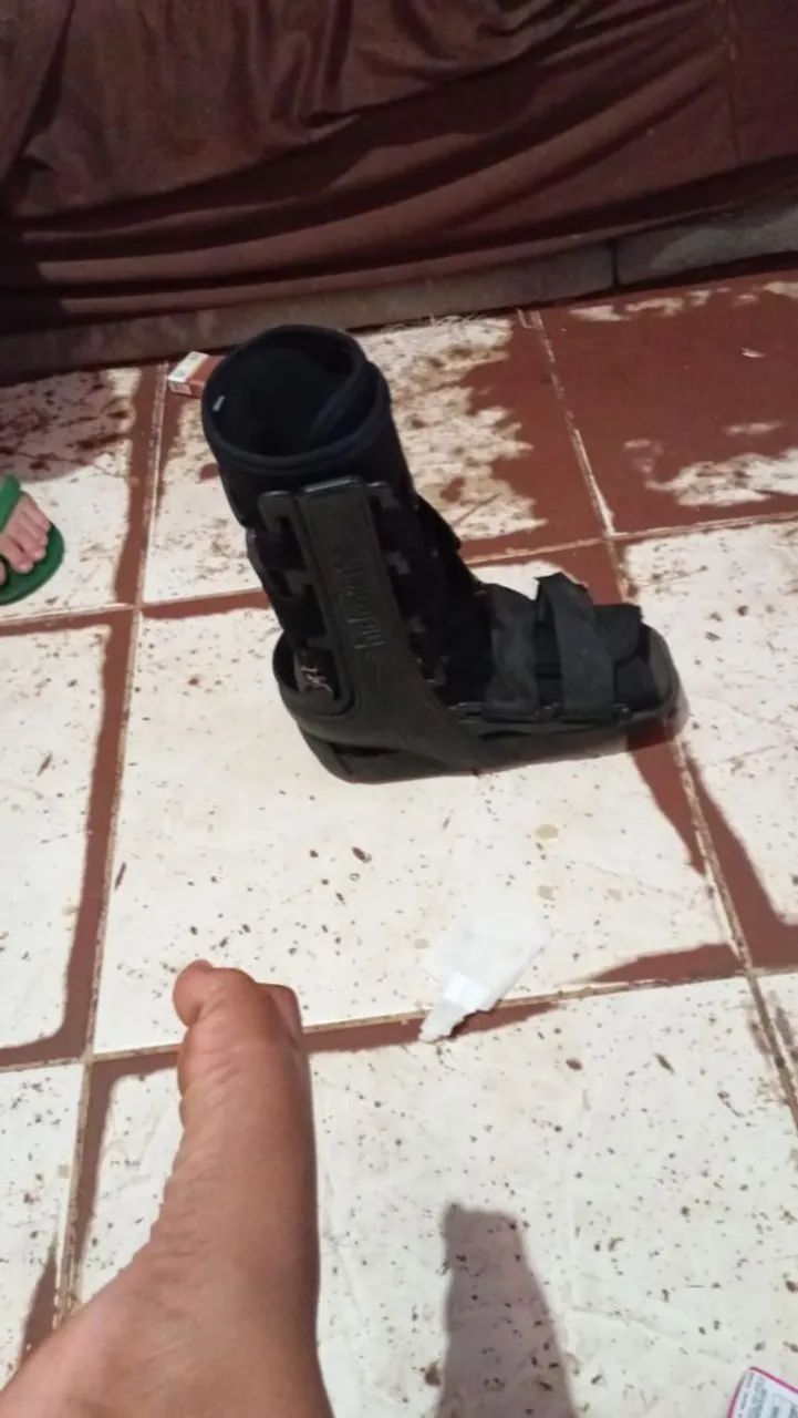 Muleta e bota apois a cirurgia inmobisadora - Foto 2