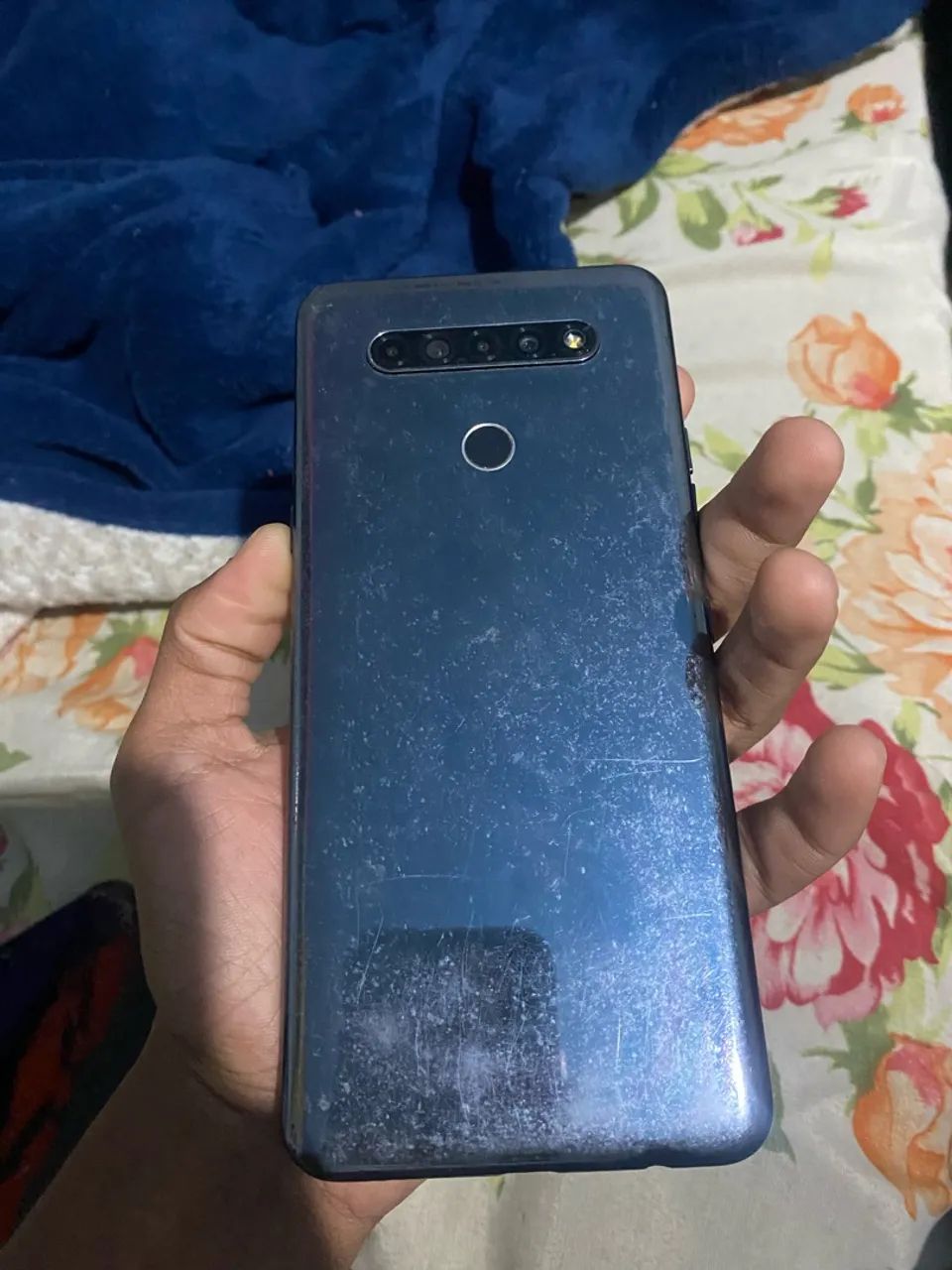 Celular com tela zoada - Foto 3