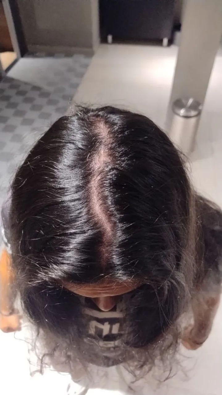 Cabelo humano - Foto 4