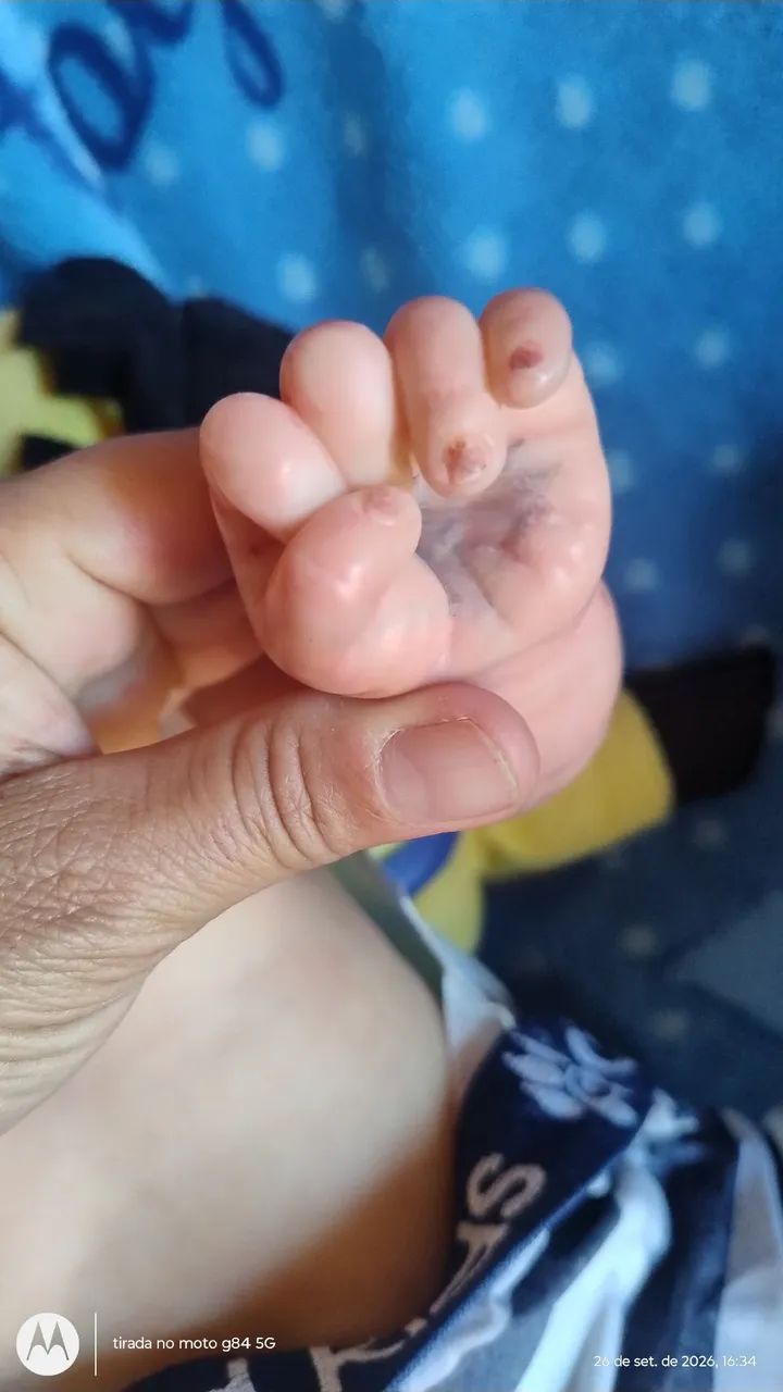 Bebê rebom  - Foto 4