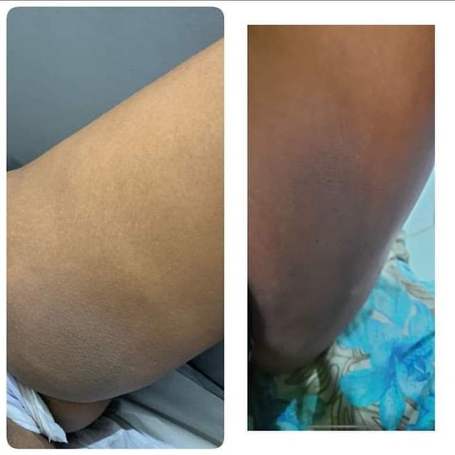 Pelling Rose de Mer - Foto 3