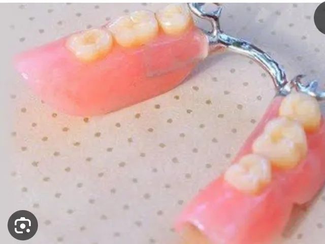 Protetico dentario faço Dentadura roach ponte móvel e flexor - Foto 4