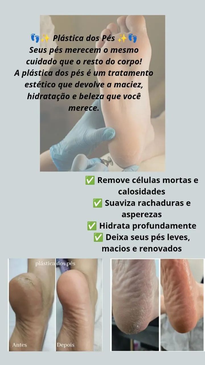 Plástica dos pés /Eldorado contagem 64167812291459120