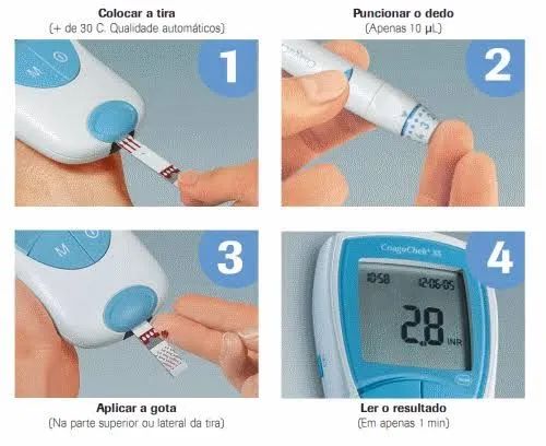 Kit Coagucheck Roche - Foto 2