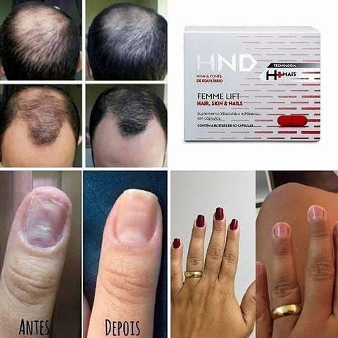 Para Cabelo, pele e unha - Pronta entrega em Porto Velho - Foto 4