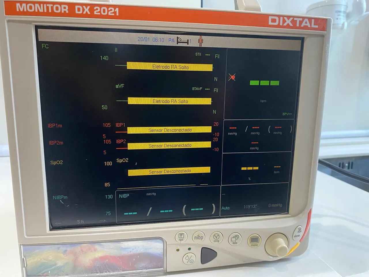 Monitor Dixtal 2021 ECG 