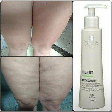 CELULIFT 150g- Maravilha de Resultados 28 dias - Foto 3