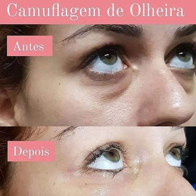 Camuflagem de Olheiras 