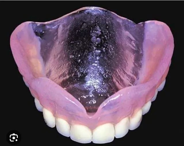 Protetico dentario faço Dentadura roach ponte móvel e flexor - Foto 5