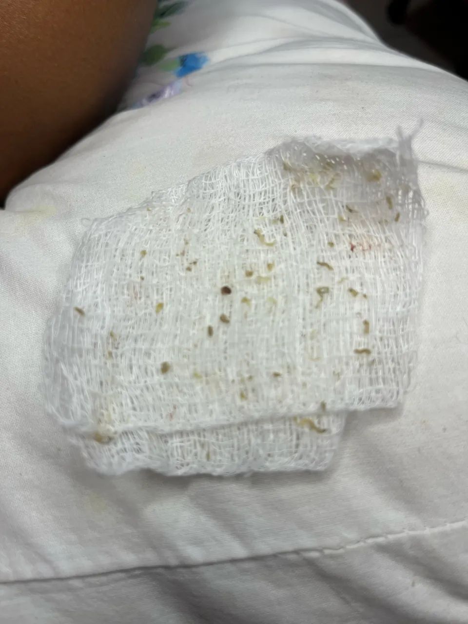 Limpeza de pele a domicílio