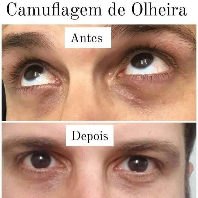 Camuflagem de Olheiras  - Foto 2