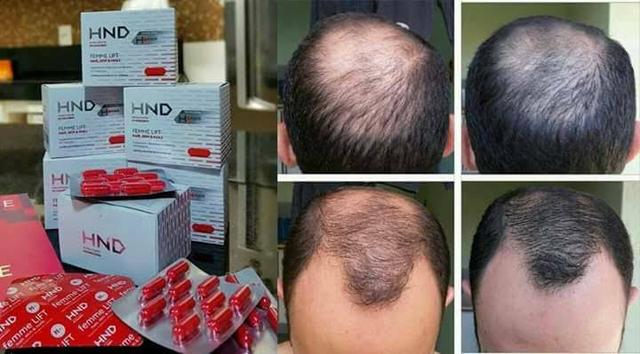 Para Cabelo, pele e unha - Pronta entrega em Porto Velho - Foto 5