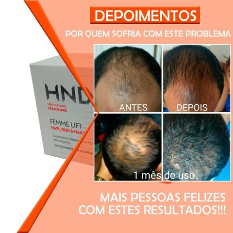 Para Cabelo, pele e unha - Pronta entrega em Porto Velho