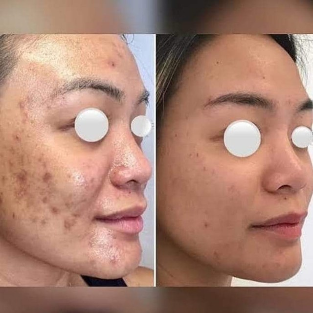 Pelling Rose de Mer - Foto 2