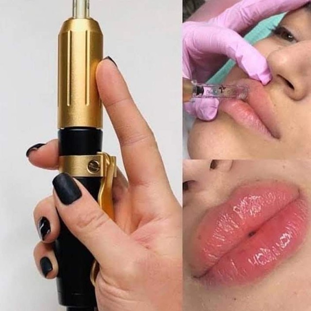 Preenchimento labial