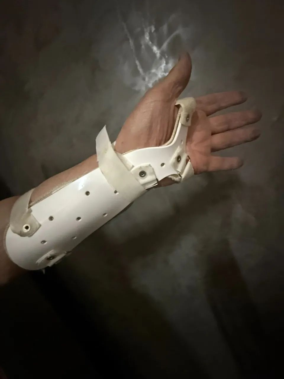 Órtese Tala De Pvc Para Punho, Pulso, Antebraço, cor Branca (Lado Esquerdo) - Foto 2
