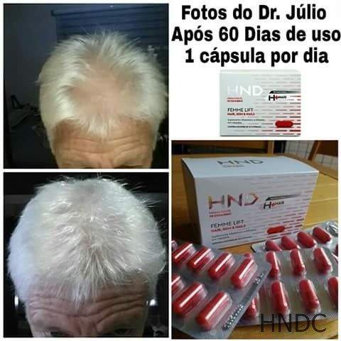 Para Cabelo, pele e unha - Pronta entrega em Porto Velho - Foto 3